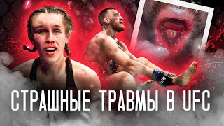 ЖУТКИЕ ТРАВМЫ БОЙЦОВ UFC! ЧТО С НИМИ СТАЛО ПОСЛЕ?! #ufc  #мма  #юфс