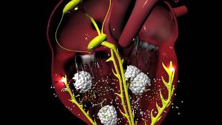 Digoxin for Arrhythmias (irregular heartbeat)