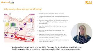 Wound Club Online Modul 3: Forsinket sårheling (5min)