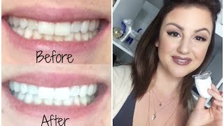 ♡ HOW TO GET SUPER WHITE TEETH! | EASY & CHEAP ♡