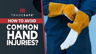 Hand Safety: 8 Expert Tips to Avoid Hand Injuries