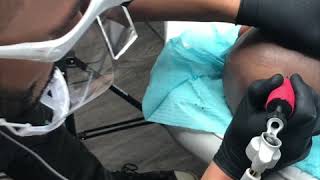 Scalp Micropigmentation (A quick demo)