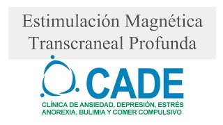 Proceso de Estimulación Magnética Transcraneal Profunda, Tratamiento para la Depresión