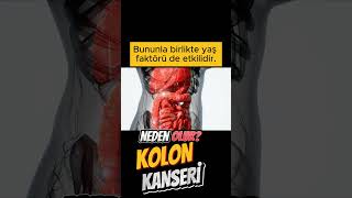 Kolon (bağırsak) kanseri neden olur? #shortsvideo