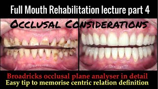 Full mouth rehabilitation lecture part 4