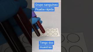 ¿Cómo se hace un grupo sanguíneo? Prueba rápida #laboratorioclinico #hematologia #short