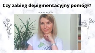 PRAWIE ROK PO ZABIEGU DERMAMELAN - opinia!