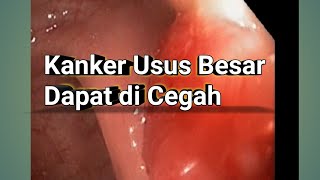 pencegahan Kanker Usus Besar dengan kolonoskopi (part I)