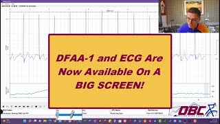 Fitness ECG and Fitness Dashboard