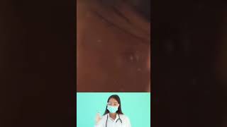 Dr.Nattacha, abscess, big cysts, extraction.