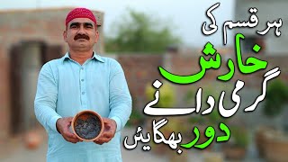 Kharish (Itching) Ka Ilaj خارش کا علاج Khujli Ki Dawa - Kharish Khatam Karne Ke MUFEED Totke In Urdu