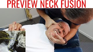 Terrible Neck ARTHRITIS get cracking by Chiropractor