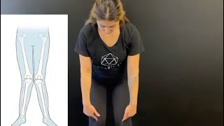 Exercises for Knock Knees | MOVABILITY