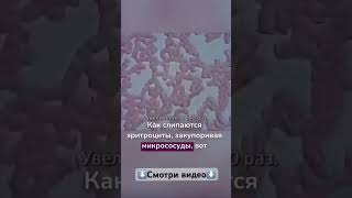 КАК #алкоголь ВЛИЯЕТ НА КРОВЬ? Смотри видео! #когнитивныеискажения