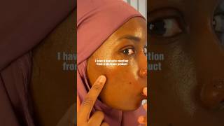 How to: Cover redness (Simple Makeup Routine) #makeup #makeuptutorial #skincare #skin #skinreaction