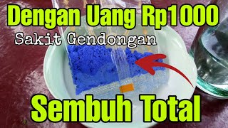 Hanya Dengan Rp1000 Sakit Gendongan Sembuh