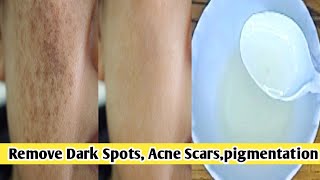 How to Remove Dark Spots, Acne Scars, Pimples Marks & Pigmentation!! Skin Do Ware #short