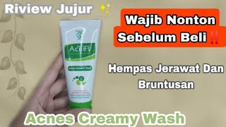 Riview Jujur Acnes Creamy Wash Pemakaian 3 Bulan