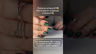 Лопнула кутикула?!😱Ногти растут в разные стороны?🙈