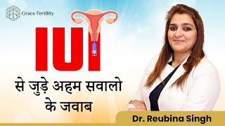 IUI से जुड़े अहम सवालो के जवाब | IUI FAQs | Grace IVF