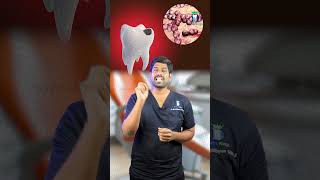 ஈறு நோய் வேறு சொத்தை வேறு!! - Caries vs Gingivitis bacteria | Dr.Karthikeyan | Denta Kings