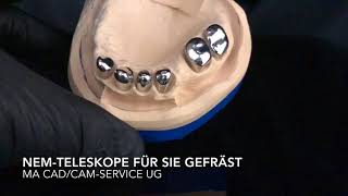 Gefräste Teleskopbrücken aus NEM, Titan oder PEEK