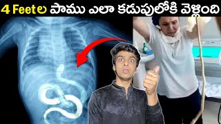 4ft SNAKE IN STOMACH  | TOP INTERESTING & AMAZING TELUGU FACTS | TELUGUDOST #123