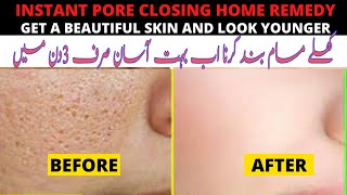 How to Close Open Pores | How to Remove Open Pores Easily | Large Pores Treatment Healthcare Remedy