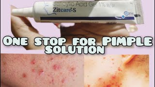 One stop solution for Pimple Zitcare S gel viral