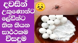 දවසින් උකුණෝ වදයට තිත😣😣#ukunonta beheth#how to remove head lice#lice#haircare#kapuru walin beheth