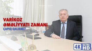 Varikoz əməliyyatı zamanı çabıq qalırmı?