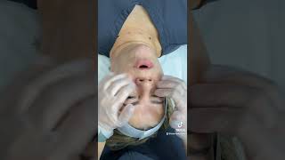 Deep Facial