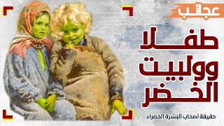 حقيقة الشقيقان أصحاب البشرة الخضراء