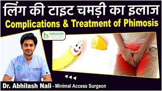 How to Deal With Tight Foreskin? || Phimosis Symptoms and Treatment in Hindi || Dr Abhilash Nali