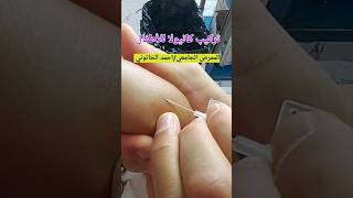 تركيب كانيولا للأطفال Cannula insertion for children