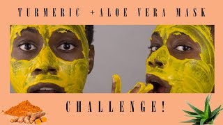 BEST FACE MASK EVER!! | Turmeric + Aloe Vera Mask | Acne-Prone Skin