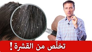 السبب الحقيقي للقشرة وأفضل علاج طبيعي - دكتور بيرج