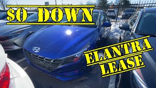 2021 Hyundai Elantra SE Lease Numbers - February 2021 !!