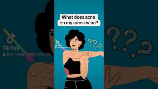 Why do I get acne on my arms? #skincareroutine