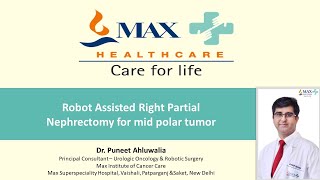 Robot Assisted Right Partial Nephrectomy for Mid Polar Tumor (#KidneyCancer) by Dr Puneet Ahluwalia