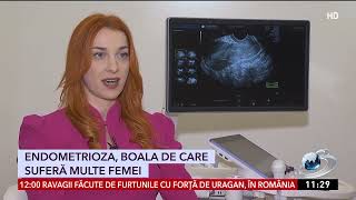 Lucruri pe care ar fi bine să le ştii despre endometrioză