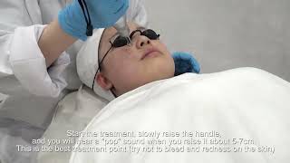 treatment for nd yag laser