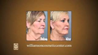 Williamson Cosmetic Center & Perenack Aesthetic Surgery Testimonials