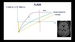 базовые последовательности: FLAIR