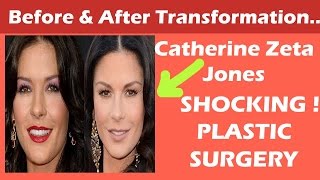 Catherine Zeta Jones Plastic Surgery Before and After Full HD