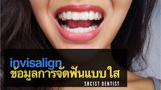 จัดฟันแบบใส ข้อมูลจัดฟันแบบใส Invisalign