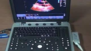 Chison SonoBook9 Step by Step Operation Training Video | KeeboMed