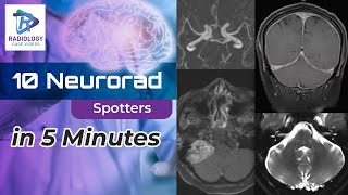 10 Neurorad Spotters in 5 Minutes