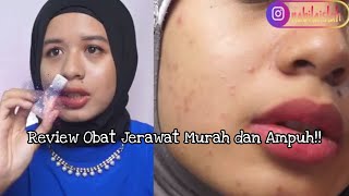 Obat Jerawat Under 15k || Ampuh + Murah