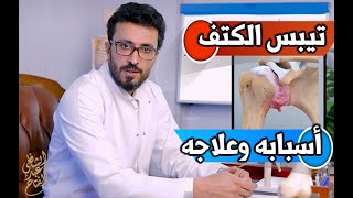 الكتف المتجمد Frozen shoulder